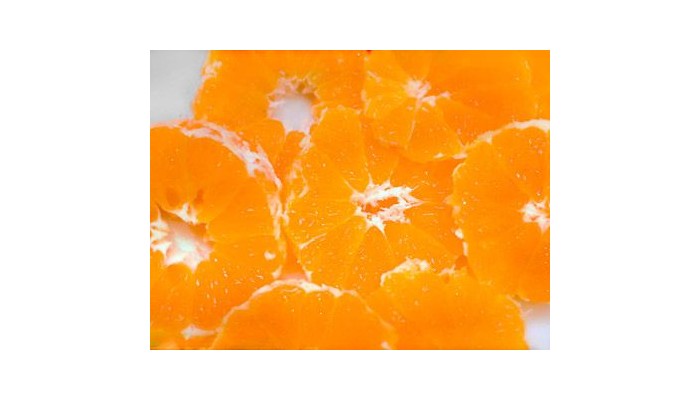 La Blanca Hotel poza 11